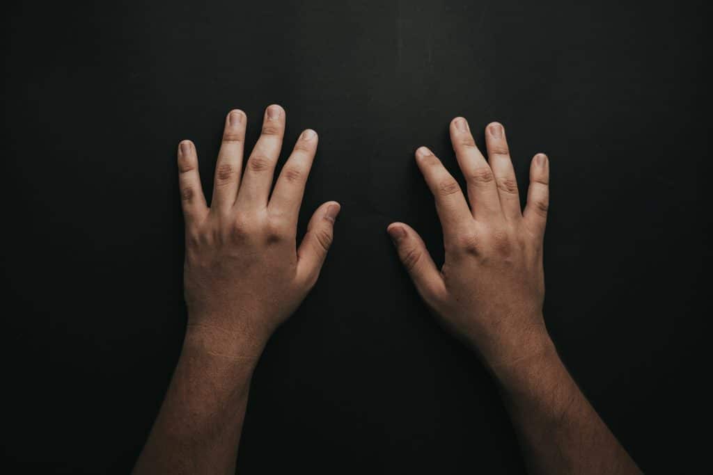 Two open hands raised against a dark background